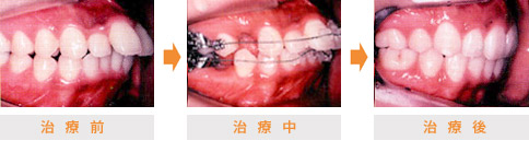 口腔内の変化 | 市ヶ谷・歯医者
