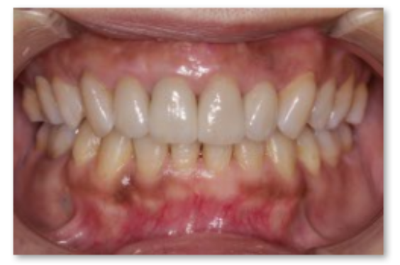 審美歯科の症例 | 市ヶ谷・歯医者