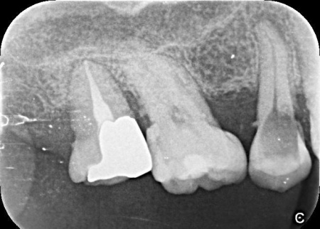 治療前 | 市ヶ谷・歯医者