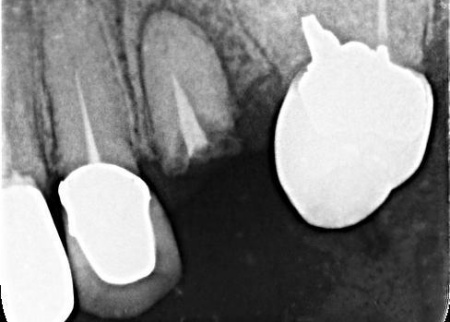 治療前 | 市ヶ谷・歯医者