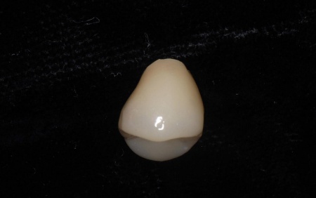 治療中 | 市ヶ谷・歯医者