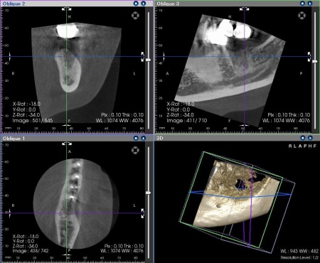 治療前 | 市ヶ谷・歯医者