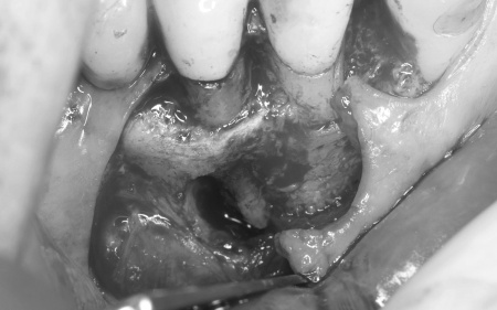 治療前 | 市ヶ谷・歯医者