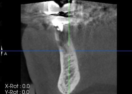 治療前 | 市ヶ谷・歯医者