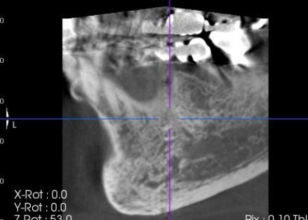 治療前 | 市ヶ谷・歯医者