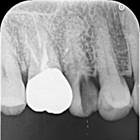 治療前 | 市ヶ谷・歯医者
