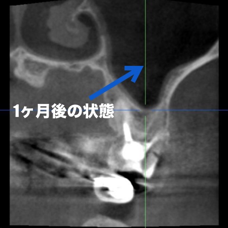 治療後 | 市ヶ谷・歯医者