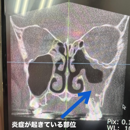 治療前 | 市ヶ谷・歯医者