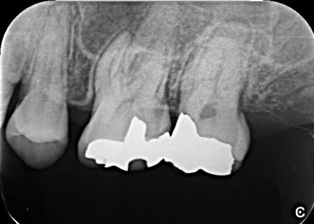 治療前 | 市ヶ谷・歯医者