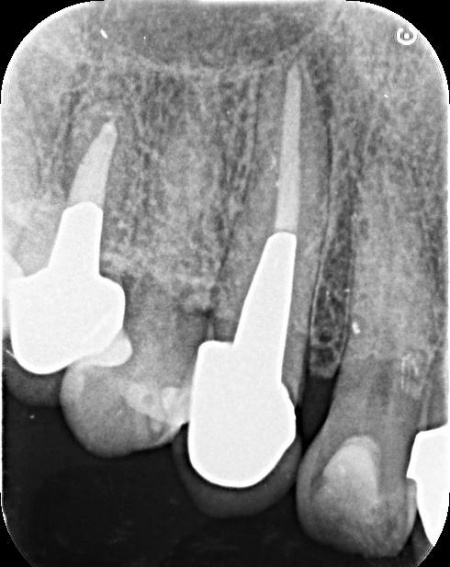 治療前 | 市ヶ谷・歯医者