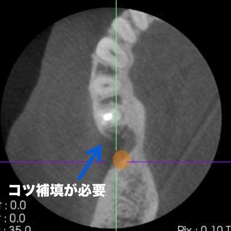 治療前 | 市ヶ谷・歯医者